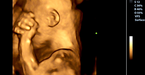 Hamilelik sırasında üzüntüden ağladığınızda bebeğinizin deneyimledikleri