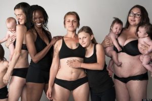 Diastasis Rectiden (Doğum Sonrası Karın Sarkması) Kurtulmak için 5 İpucu