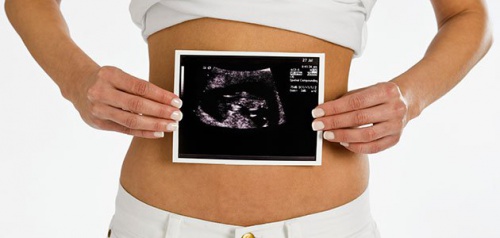 ultrason resmi ve anne