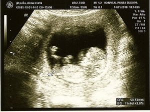 Hamilelikte Oluşabilecek Sorunları Belirleyen Yenilikçi Teknikler