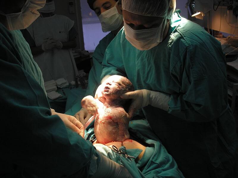 doğum sırasında bebek