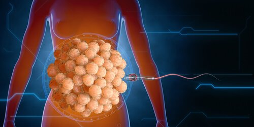 Spermin Yaşam Savaşı