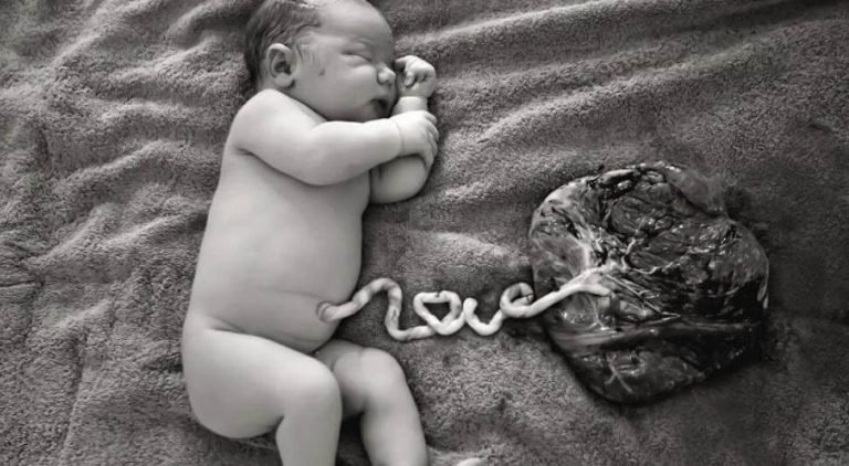 yenidoğan ve göbek bağı