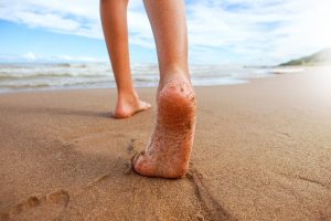 Çocuklarda Çarpık Bacak Nasıl Düzeltilir?