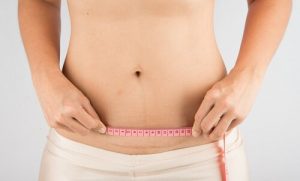 Doğumdan Sonra Sezaryen Yarası Nasıl İyileştirilir?