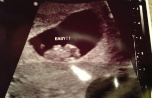 Çocuğunuzun Cinsiyetini Belirleyebilmek İçin Ramzi Metodu