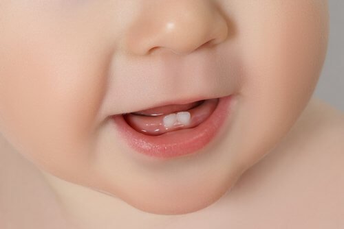 Bebeklerin diş çıkarması