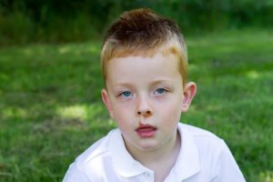 Impetigo hastalığı çocuklarda bulaşıcı!