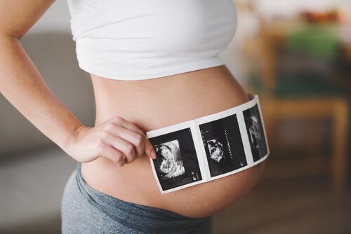 karnında ultrason fotoğrafı tutan gebe kadın