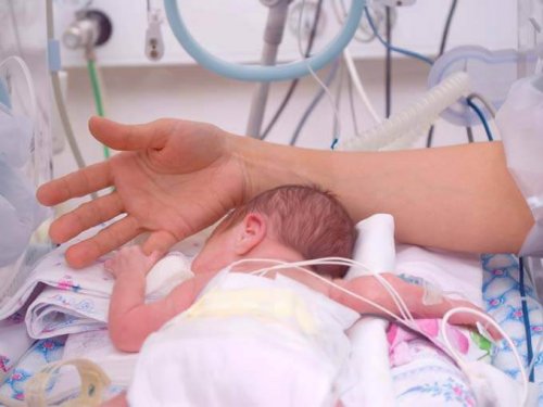 prematüre bebek