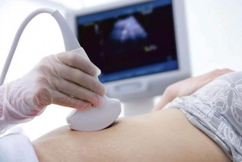 sonogram yaptiran kadin