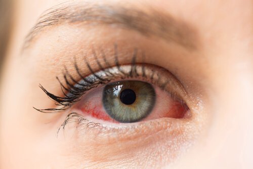 Çocuklarda Pembe Göz Hastalığının Yayılmasını Önleyin