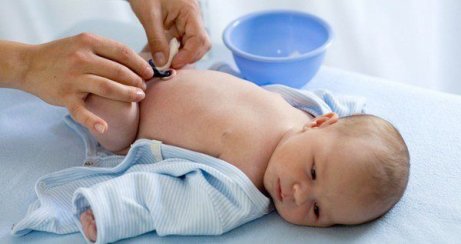 göbek kordonu bakımı