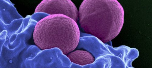 bebeklerde düşük nötrofil