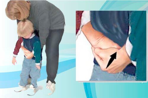 heimlich manevrası ile ilkyardım uygulaması