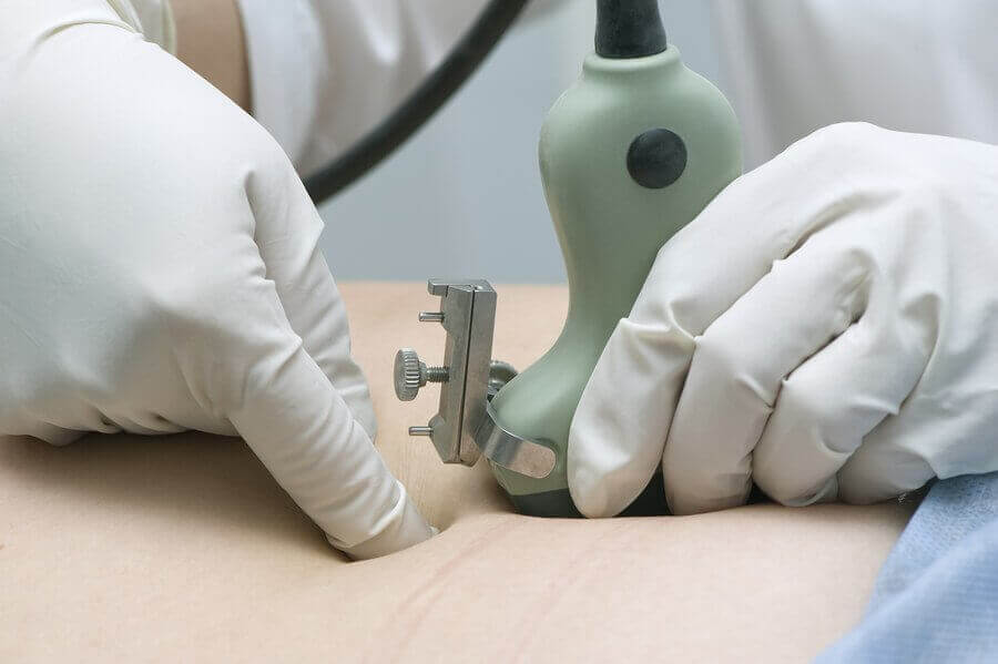 oligohidramniyoz tedavisi