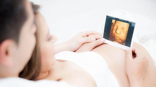 bebeğin ultrason görüntüsü