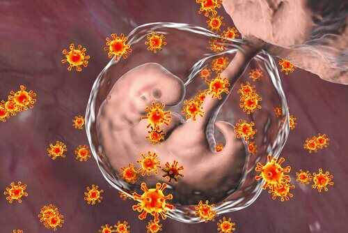 Hamilelikte herpes enfeksiyonu bulaşan fetus