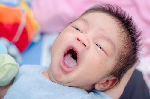 Oral Pamukçuk: Nedenleri, Belirtileri ve Önlenmesi