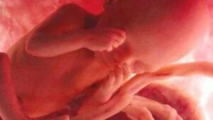 Hamilelikte İçilen Sigara Bebeğinizin DNA'sını Değiştirebilir