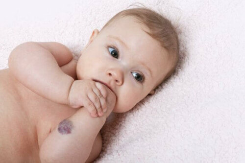 Bebeklerde Yaygın Görülen Kraniyofasiyal Anomaliler