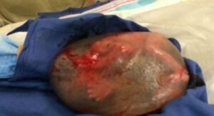 Amniyotik kese içinde doğmuş bebek