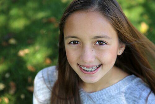 diş teli takan kız