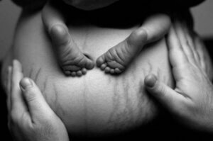 Doğum Sonrası Kadın Bedeninin Güzelliği