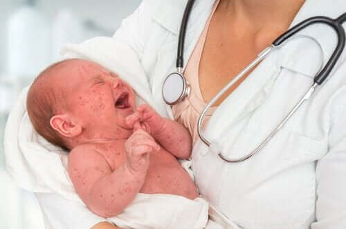 Doktorun kucağında ağlayan kızamık olmuş bebek