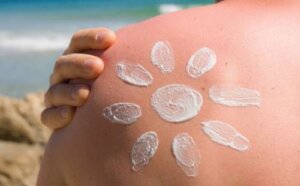 Güneş Yanıklarını Tedavi Etmek İçin Ne Yapmalısınız?