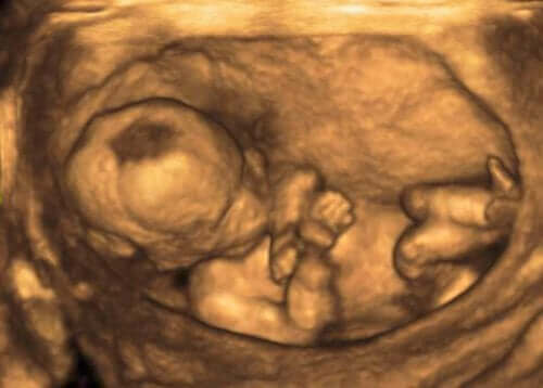 ultrason bebek