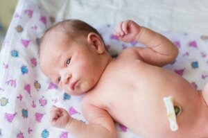 Bebeklerde Göbek Deliği İle İlgili Yapılan 6 Hata