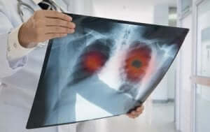 Röntgen filmini inceleyen doktor